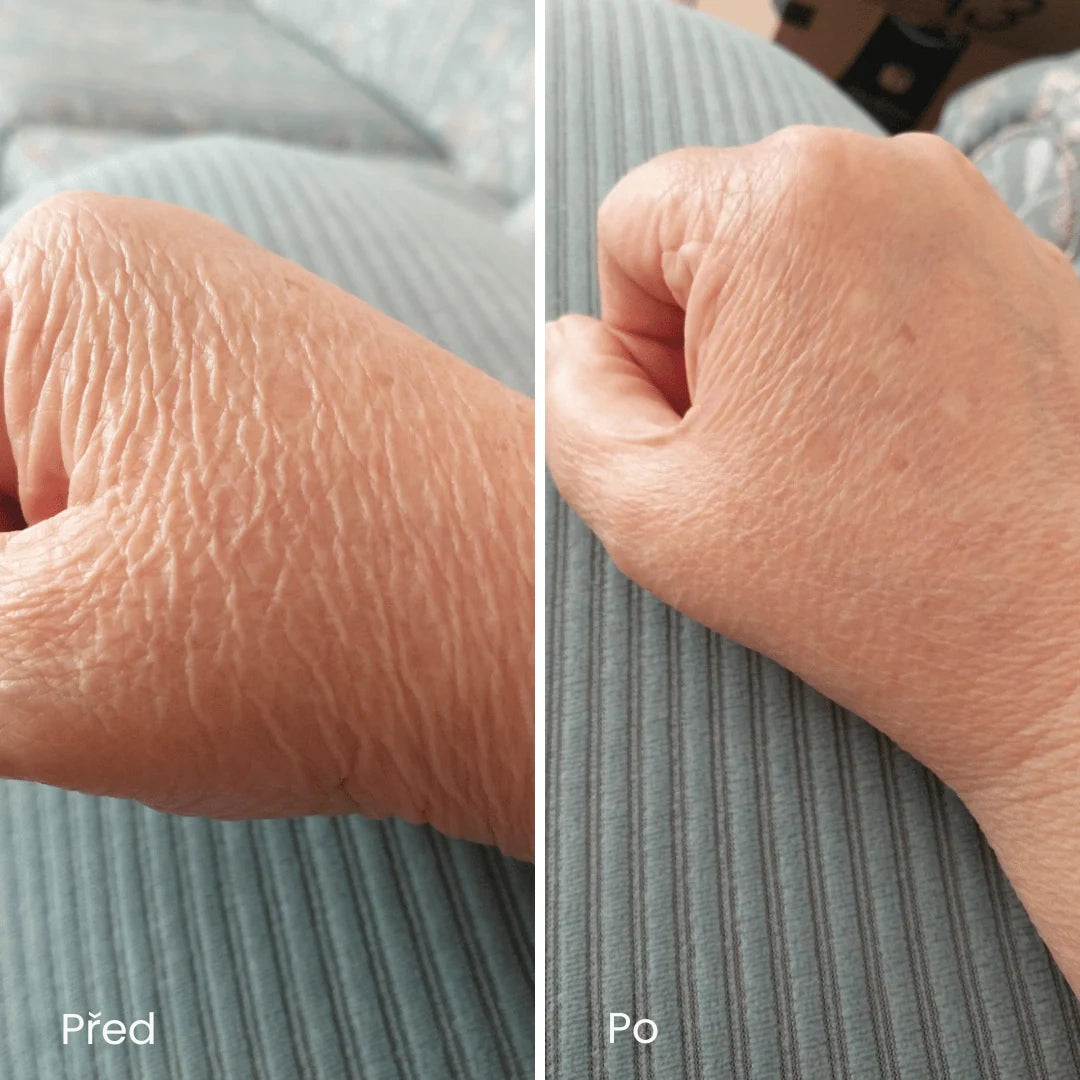 Novaderm™ | Krém na opravu pokožky