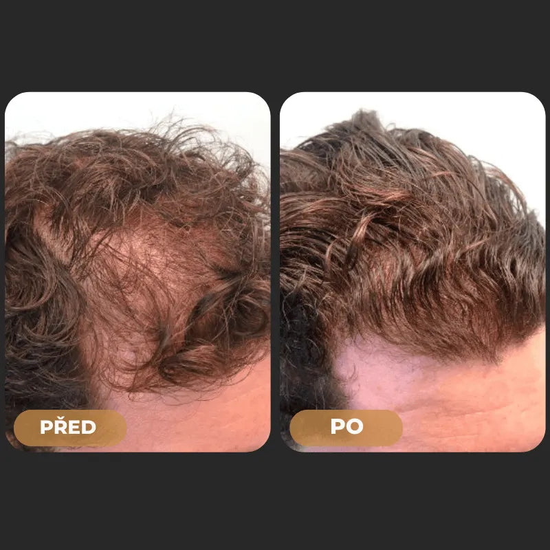 Orylo™ RootBoost Šampon pro oživení vlasů