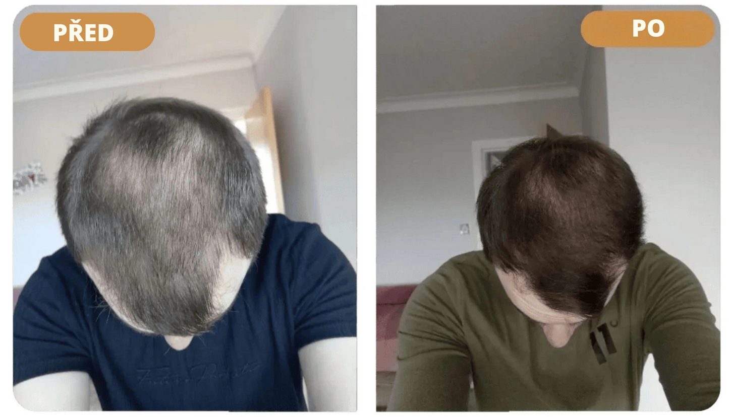 Orylo™ RootBoost Šampon pro oživení vlasů