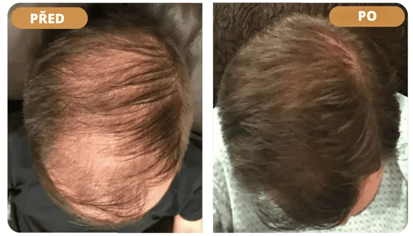 Orylo™ RootBoost Šampon pro oživení vlasů
