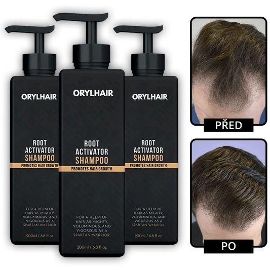 Orylo™ RootBoost Šampon pro revitalizaci vlasů -V2 (CZ)