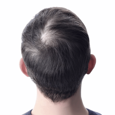 Orylo™ RootBoost Šampon pro oživení vlasů
