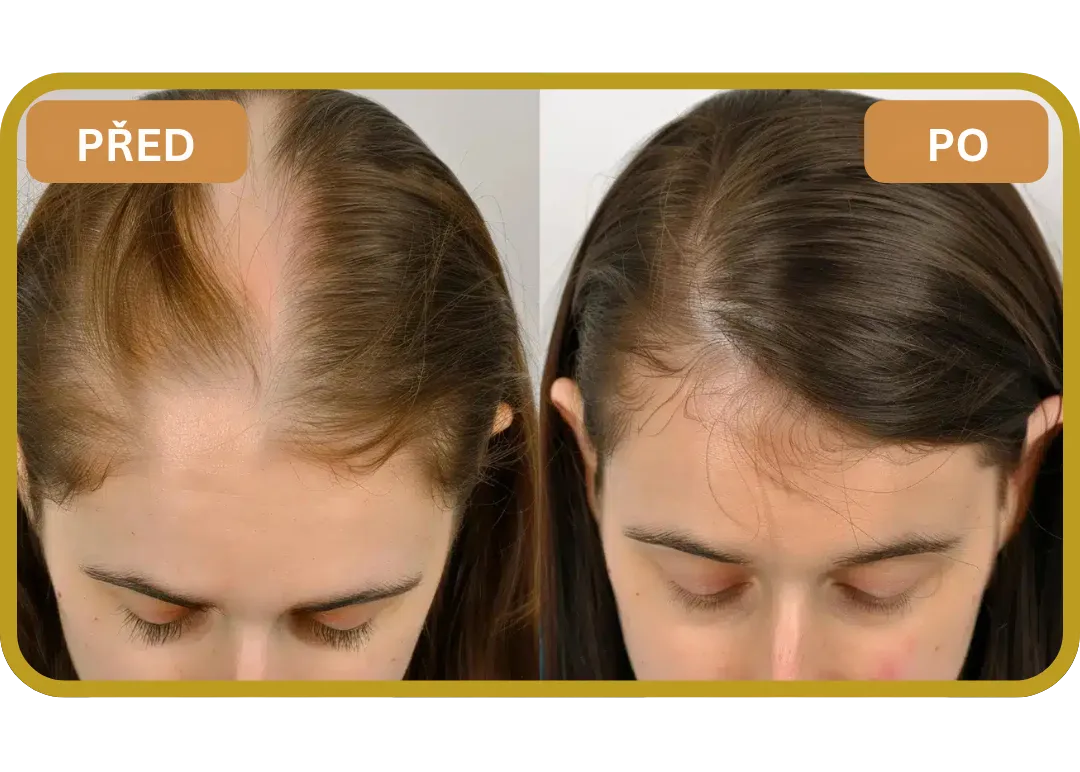 Orylo™ RootBoost Šampon pro regeneraci vlasů v2 (Women)