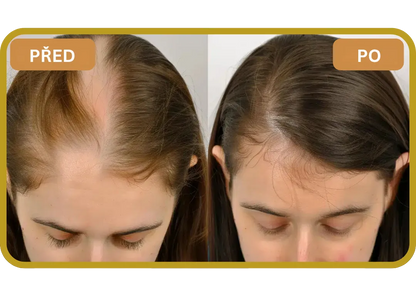 Orylo™ RootBoost Šampon pro regeneraci vlasů v2 (Women)