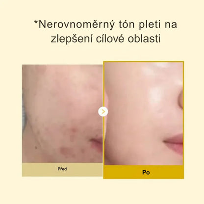 Maska s kyselinou kojovou a kurkumou
