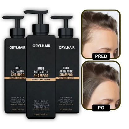 Orylo™ RootBoost Šampon pro regeneraci vlasů v2 (Women)
