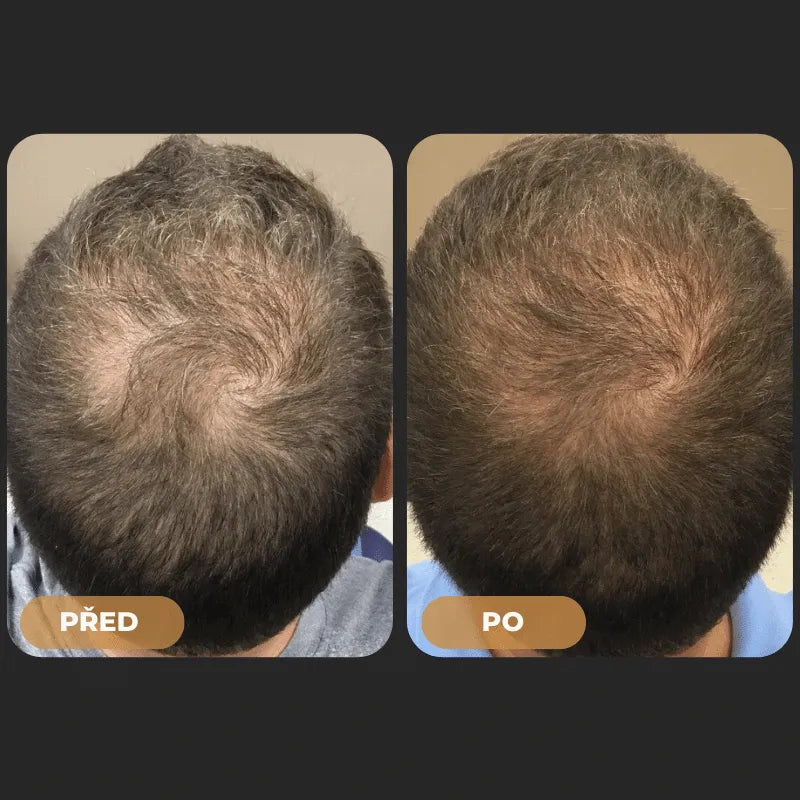 Orylo™ RootBoost Šampon pro revitalizaci vlasů -V2 (CZ)