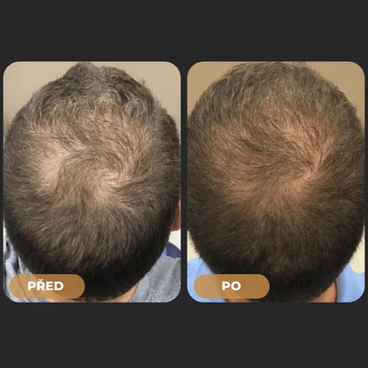 Orylo™ RootBoost Šampon pro oživení vlasů