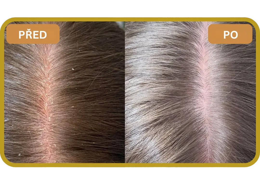 Orylo™ RootBoost Šampon pro regeneraci vlasů v2 (Women)