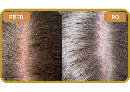 Orylo™ RootBoost Šampon pro regeneraci vlasů v2 (Women)