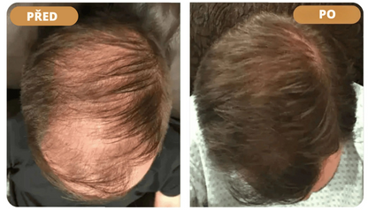 Orylo™ RootBoost Šampon pro oživení vlasů