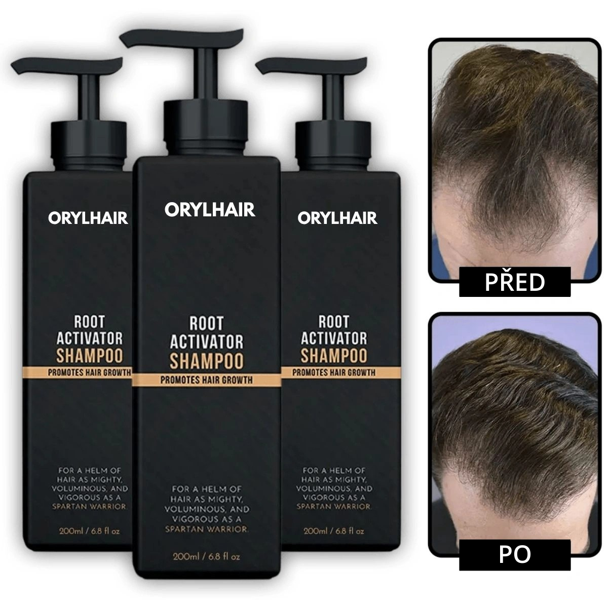 Orylo™ RootBoost Šampon pro revitalizaci vlasů -V2 (CZ)