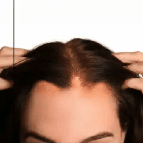 Orylo™ RootBoost Šampon pro regeneraci vlasů v2 (Women)